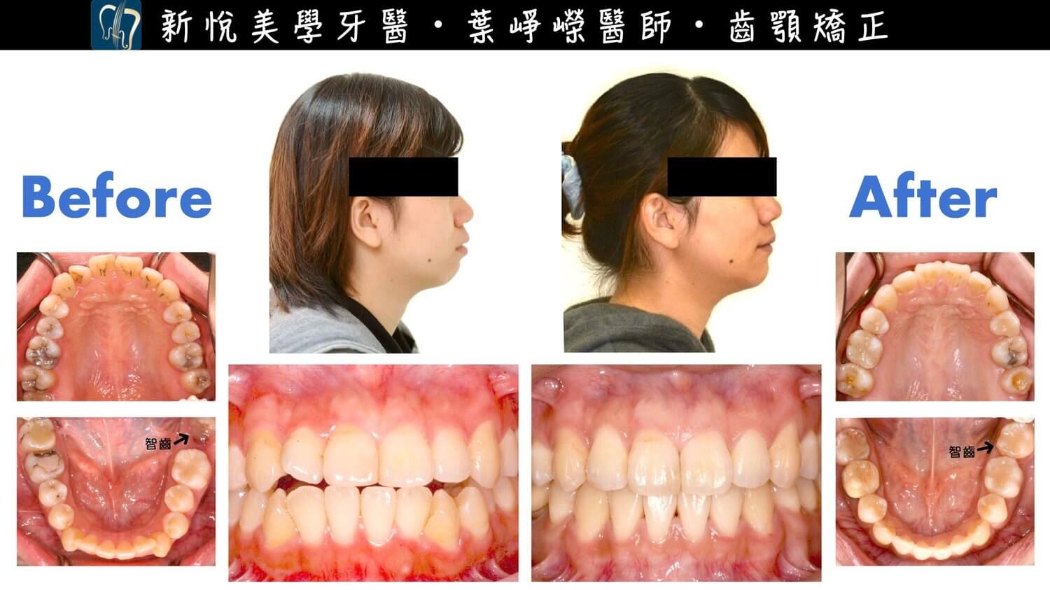 新悅美學牙醫診所的案例分享圖片